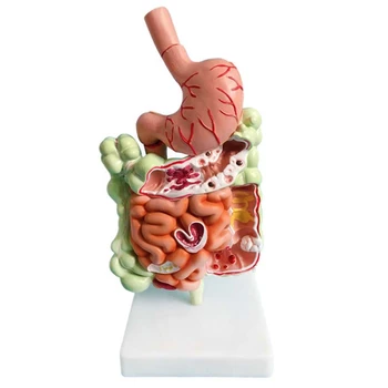 Модел на човешката храносмилателна система Анатомия на стомаха Черва Cecum Rectum Duodenum Човешки вътрешни органи Структура Модел